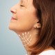 When Should You Consider a Neck Lift Surgery?