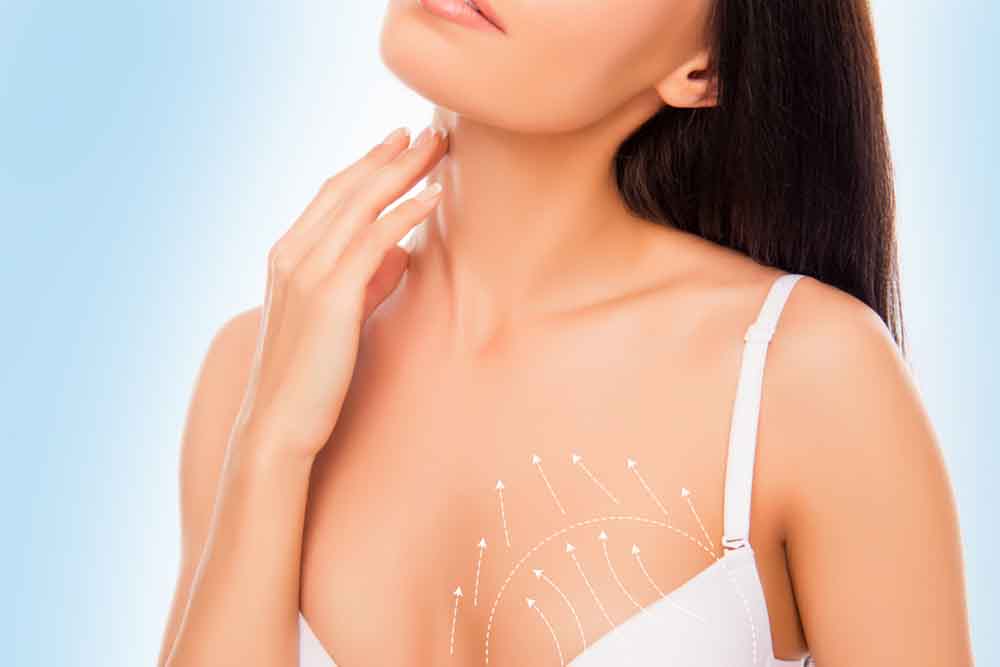 Breast Lift