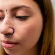 Nasal Deviation and Aesthetic Surgery: Everything You Need to Know