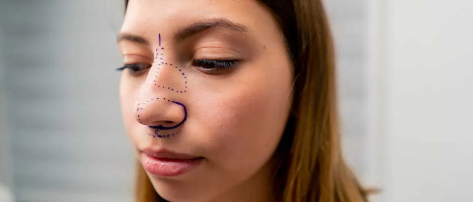 Nasal Deviation and Aesthetic Surgery: Everything You Need to Know