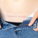 Important Tips for Reducing Scars After Cosmetic Surgery