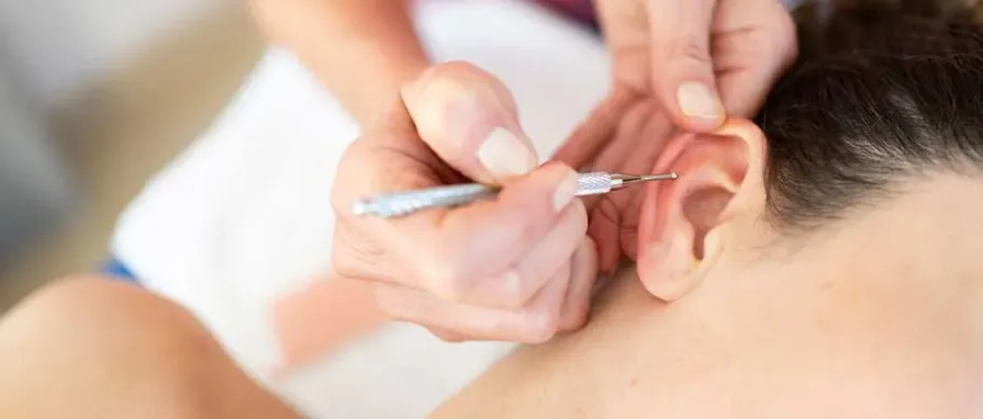 The Latest Techniques in Ear Aesthetic Surgery (Otoplasty)