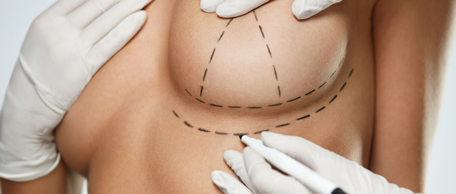 Breast - Dr. Burak Pasinlioğlu