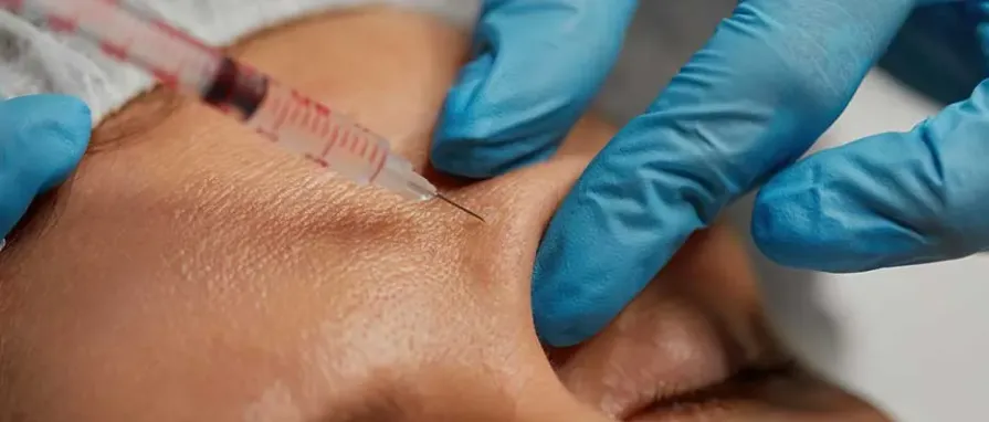 ¿Es Posible un Rejuvenecimiento Natural con Inyección de Grasa Facial?