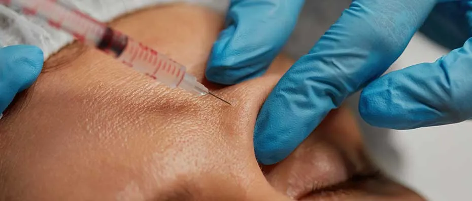 Is Natural Facial Rejuvenation Possible with Fat Injection?